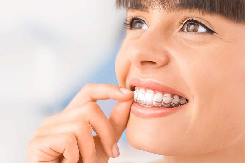 Dental Treatments in South Euclid